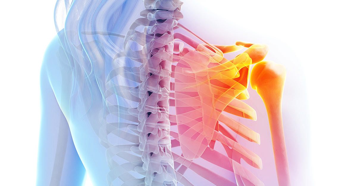 San Angelo shoulder pain treatment and recovery